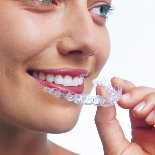 5 Clear Benefits of Choosing Invisalign Over Braces
