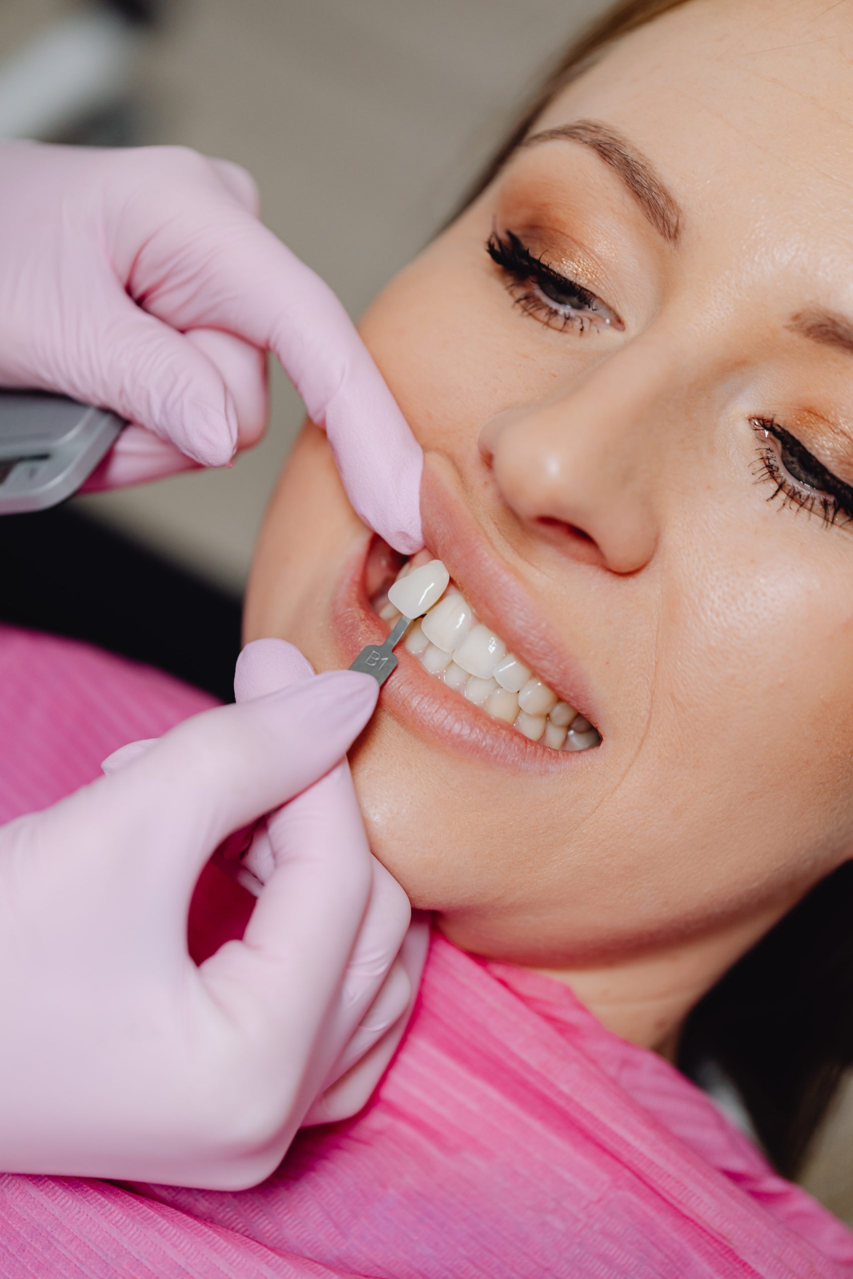 Cosmetic dentist matching tooth shade for veneer treatment at Yonge Forest Dental in Barrie