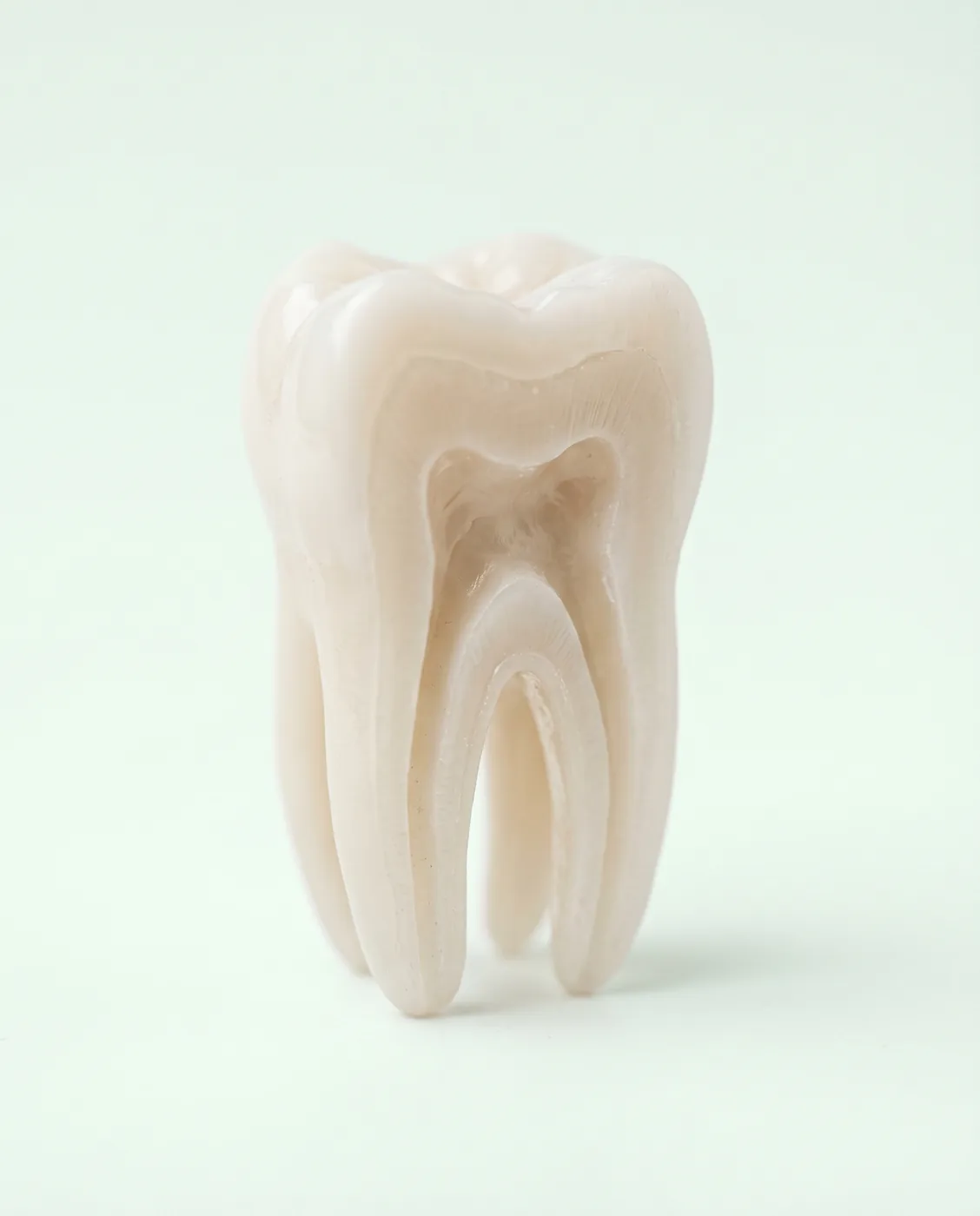 Root canal tooth model at Yonge Forest Dental