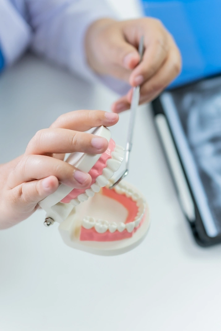 Hand holding a dental model used to explain tooth structure at Yonge Forest Dental in Barrie