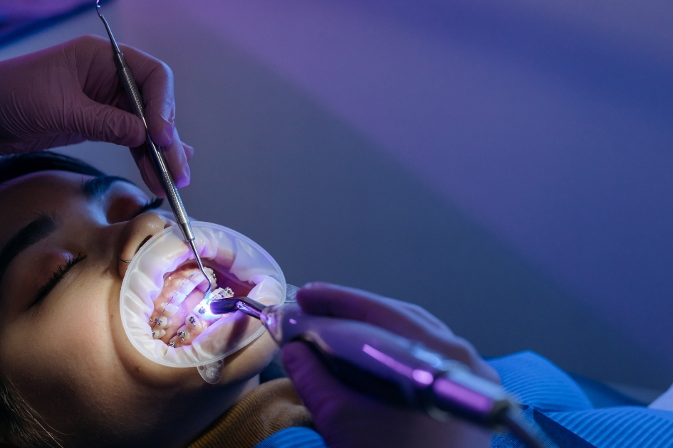 Urgent dental care procedure with cheek retractor and curing light – Yonge Forest Dental Barrie.